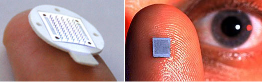 microneedles drug delivery system
