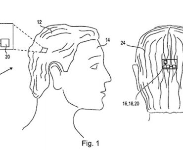 When Hairy Met Sony: Moves Made to Pioneer the World’s First Intelligent Hairpiece
