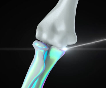 The ADAM Project Simplifies 3D Bone Printing