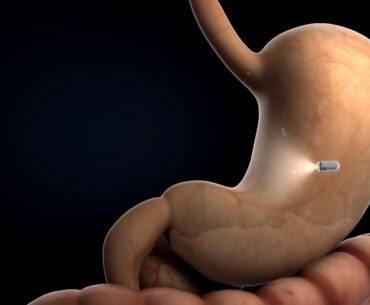 gastric endoscope capsule